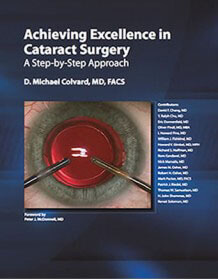 Achieving Excellence in Cataract Surgery - A Step-by-Stop Approach by Dr. Michael Colvard, MD, FACS